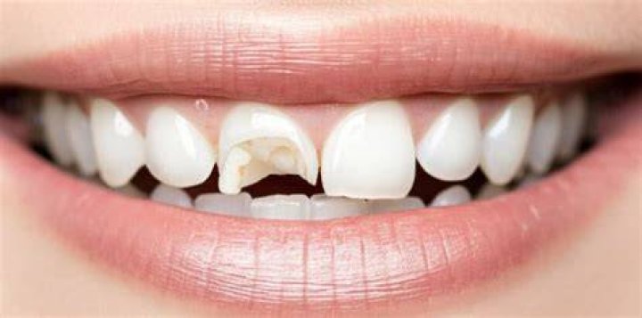 Can broken teeth grow back?