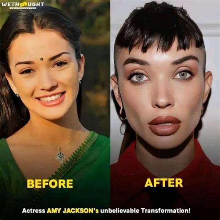 Does Amy Jackson have plastic surgery?