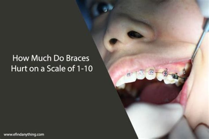 How much do braces hurt?