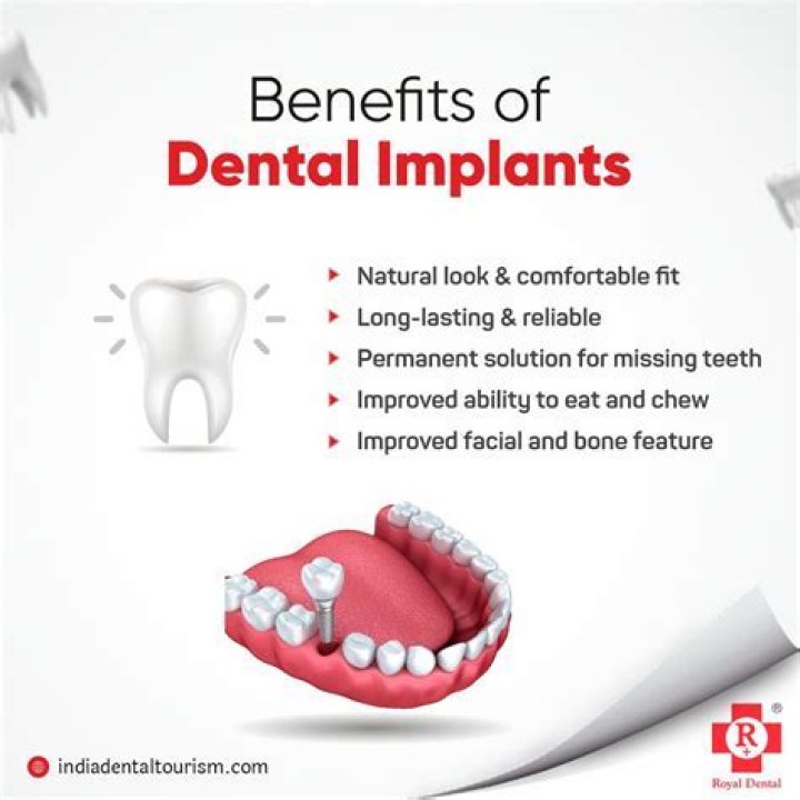What dental category do implants fall under?